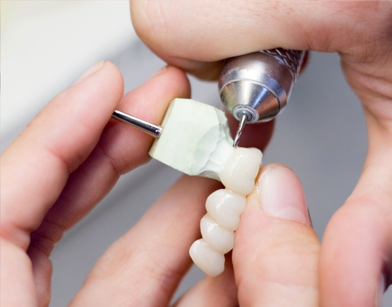 Choosing a Dental Lab